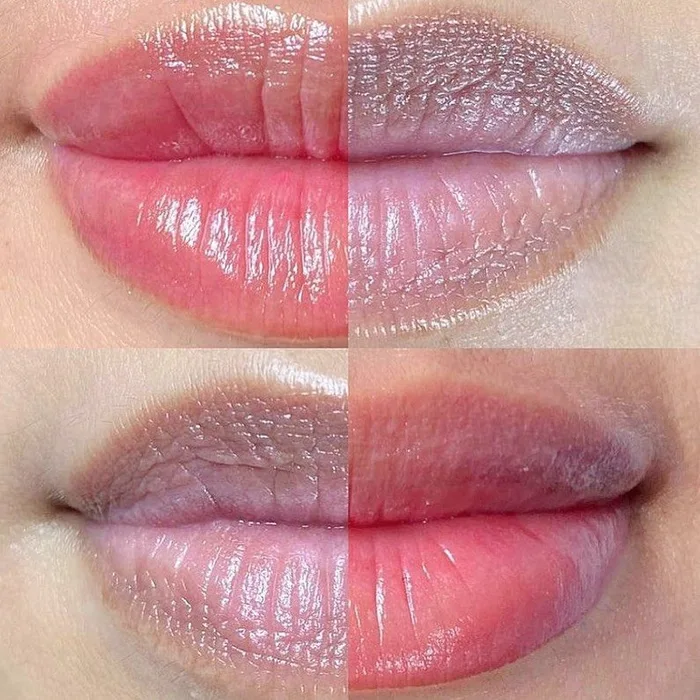 Neutralización de Labios