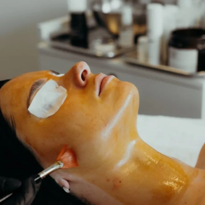 Peeling Químico